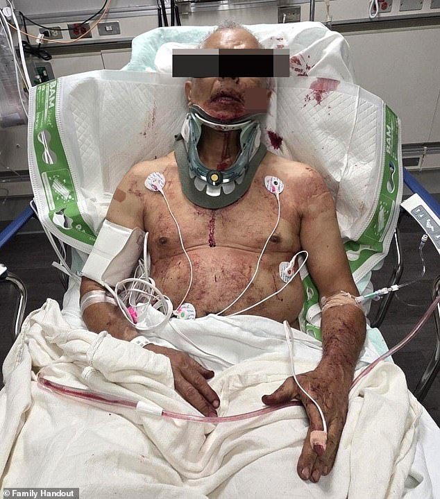 Terribles heridas de puñalada de Grease Truck Driver (69) después de que fue atacado “por la ex estrella de la NFL Mark Sánchez a través del estacionamiento”.