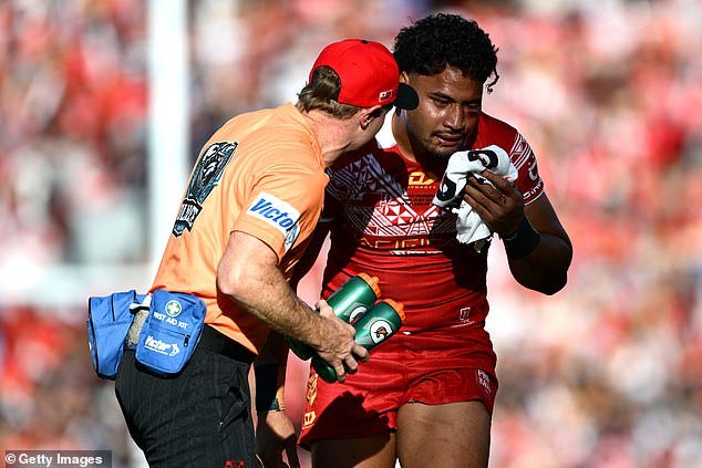 El técnico de Tonga defiende el trato dado al jugador que sufrió tres golpes en la cabeza y requirió atención médica