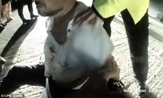 Fue entonces cuando arrestaron a un acomodador borracho después de morderle el dedo a un compañero invitado en la boda de su mejor amigo.