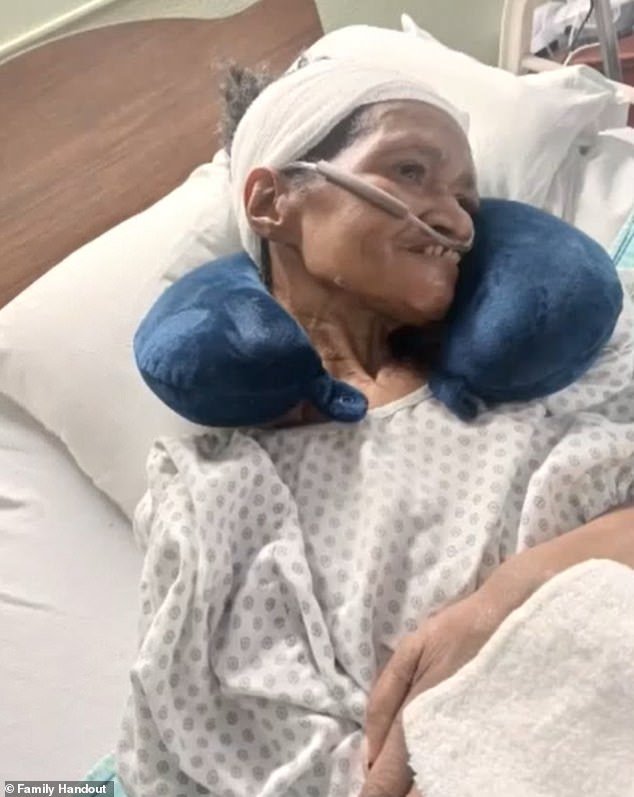 El torpe personal del hospital pierde un trozo del cráneo de una mujer durante una cirugía y luego le ofrece una tarjeta de regalo de gasolinera por valor de 25 dólares para colmo de males.