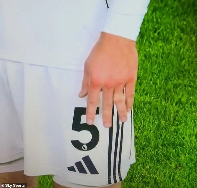 La estrella del Fulham sufre una lesión TERRIBLE tan grave que no puede ver cómo los paramédicos le devuelven el hueso a su lugar.