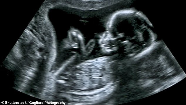 No es ilegal que los indios británicos aborten bebés porque son niñas, según la organización benéfica Fury