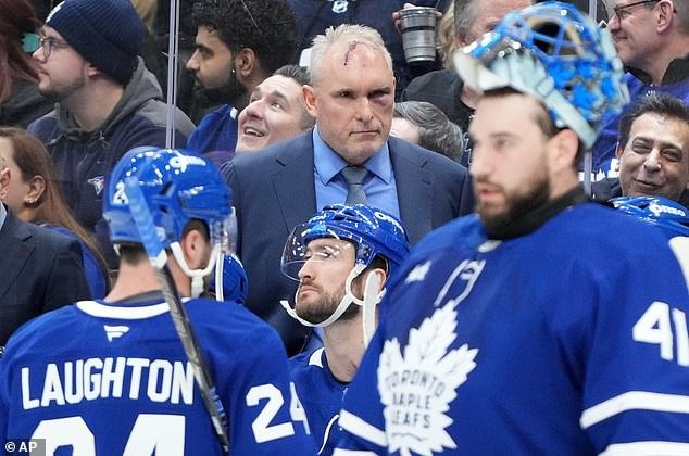 El entrenador de los Toronto Maple Leafs, Craig Berube, aparece con una horrible lesión en la cabeza después de un extraño accidente en el gimnasio