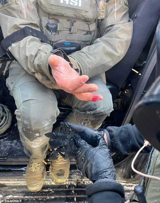 ‘Los alborotadores muerden’ el dedo de un oficial de policía mientras estallan las protestas después del tiroteo mortal de la Patrulla Fronteriza en Minneapolis