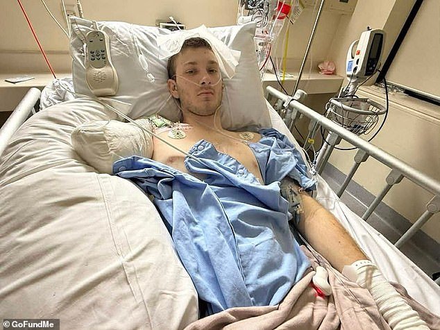 Un adolescente australiano pierde su brazo en un terrible accidente laboral, apenas unas semanas antes de completar su formación.