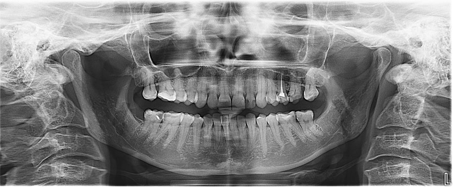 Cómo un DSO líder utilizó la analítica para aumentar las tasas de programación de tratamientos de coronas en un 26 %