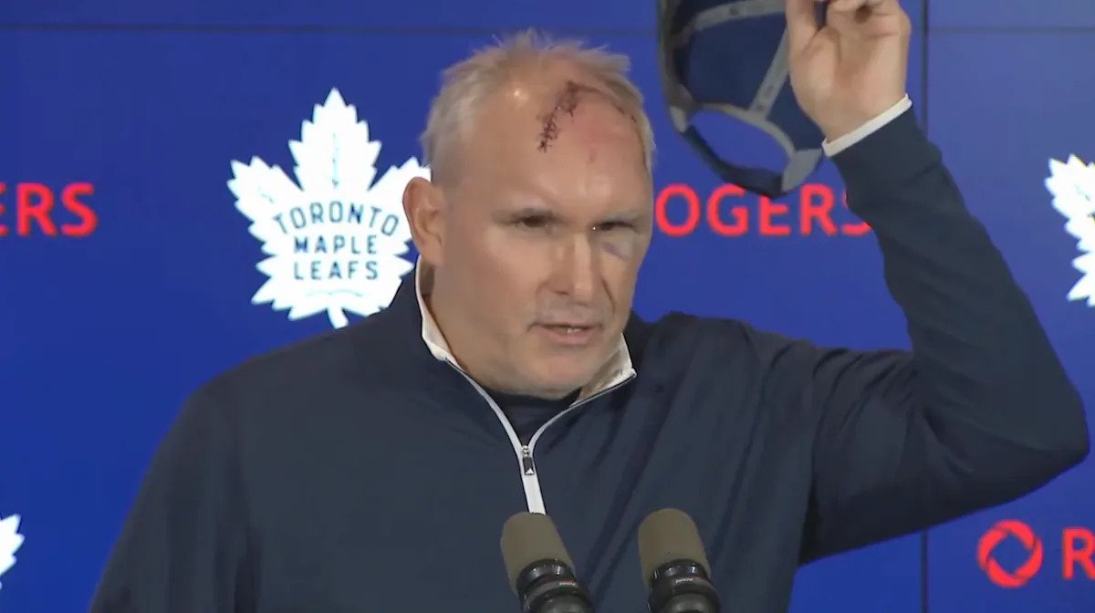El entrenador de los Maple Leafs, Craig Berube, dice que sufrió un corte grave y un hematoma en un ojo en un “estúpido” accidente en el gimnasio.