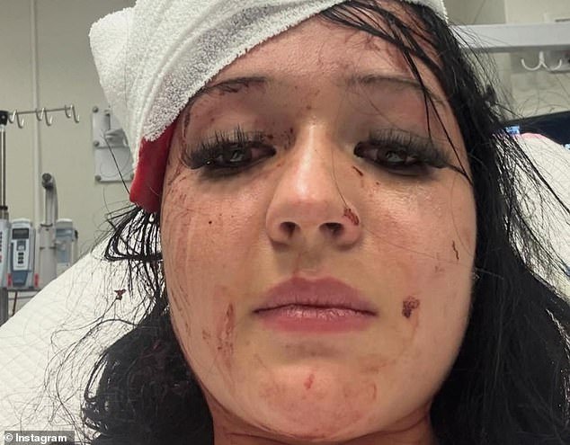 La hermana de una mujer de 20 años que supuestamente fue apuñalada por su colega despreciado en el club de la liga describe el horrible ataque y elogia al héroe que la salvó.