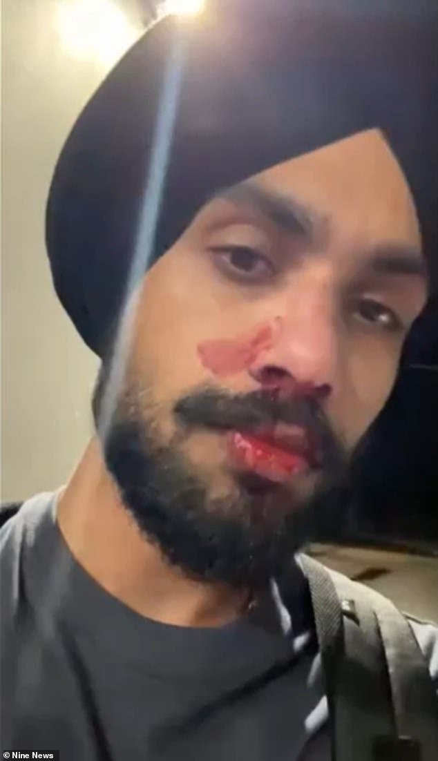 ‘Vuelve a tu barco’: joven enfermero se rompió la nariz después de supuestamente sufrir abusos raciales y un cabezazo cuando salía del gimnasio Planet Fitness en Corio