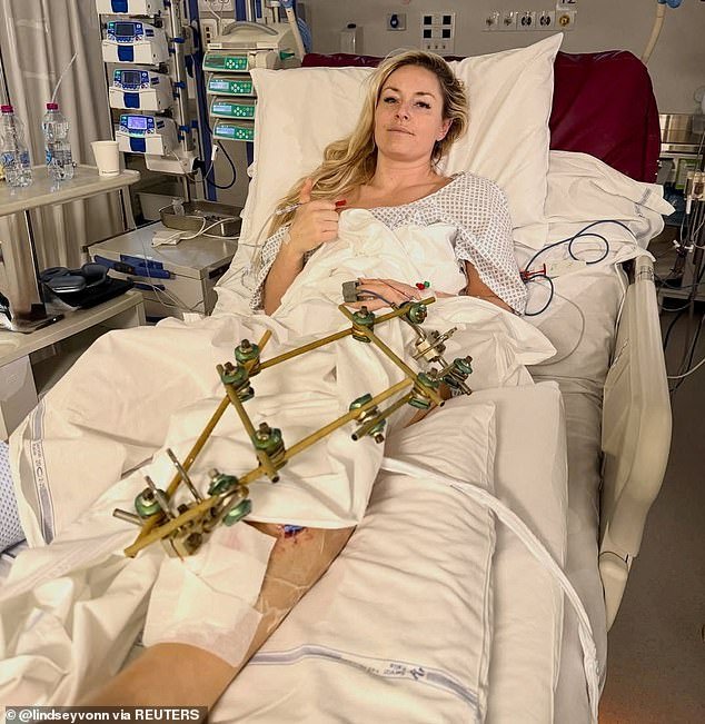 Lindsey Vonn está respondiendo a los ‘haters’ desde su cama de hospital después de que le dijeron que era ‘egoísta’ al asegurarse un lugar olímpico antes de sufrir una horrible fractura en una pierna a los 41 años.