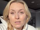 Lindsey Vonn finalmente sale del hospital después del terrible accidente de los Juegos Olímpicos de Invierno y revela cómo el médico salvó ‘su pierna’ de la amputación