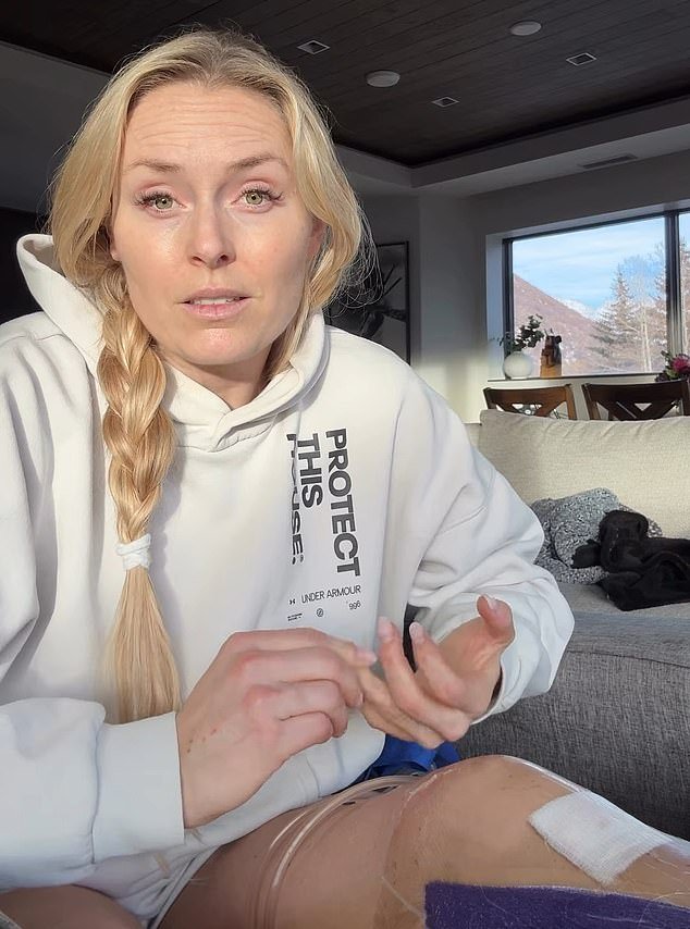 Lindsey Vonn habla sobre la batalla mental “oscura e implacable” después del accidente de los Juegos Olímpicos de Invierno: “Me golpeó como una tonelada de ladrillos”
