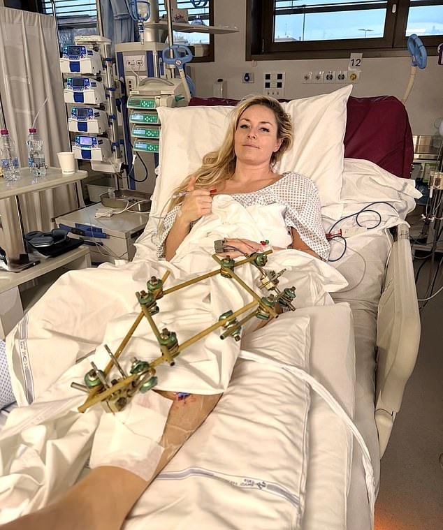 Lindsey Vonn insinúa volver a esquiar a pesar de someterse a la cuarta operación de su pierna rota tras el terrible accidente en los Juegos Olímpicos de Invierno.