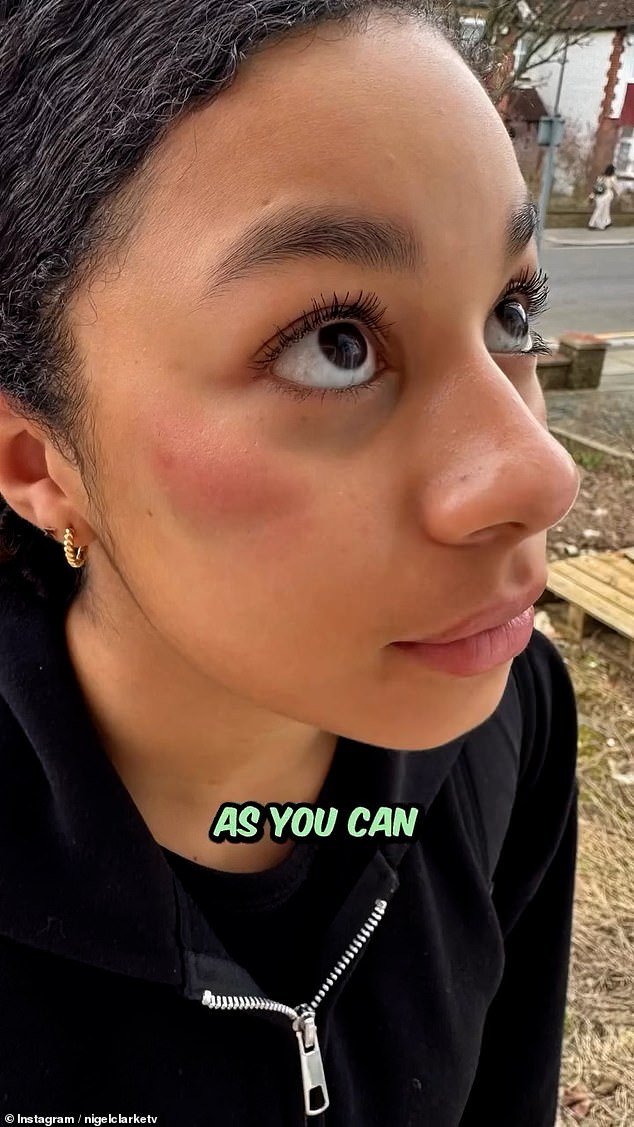 El presentador de CBeebies dice que su hija, de 16 años, sufrió un ojo morado después de un robo en el metro