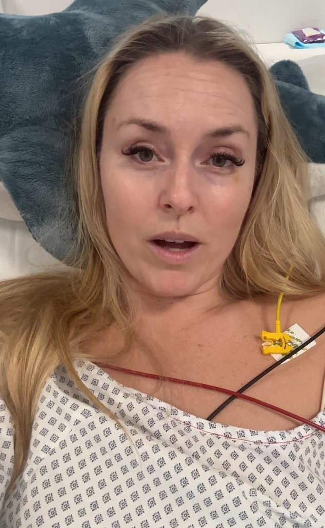 Lindsey Vonn llora al perder su prestigioso honor de esquiar después de una terrible fractura en una pierna