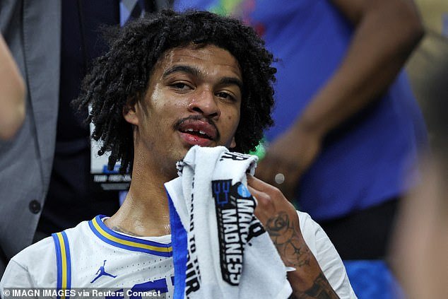 La estrella de March Madness pierde su DIENTE después de golpearse en la cara con el codo… antes de que su compañero lo encuentre en la cancha