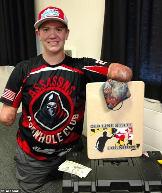 Los jugadores profesionales de cornhole sin brazos ni piernas se enfrentan a impactantes cargos de asesinato… pero es sólo el último giro de una historia de vida verdaderamente impactante.