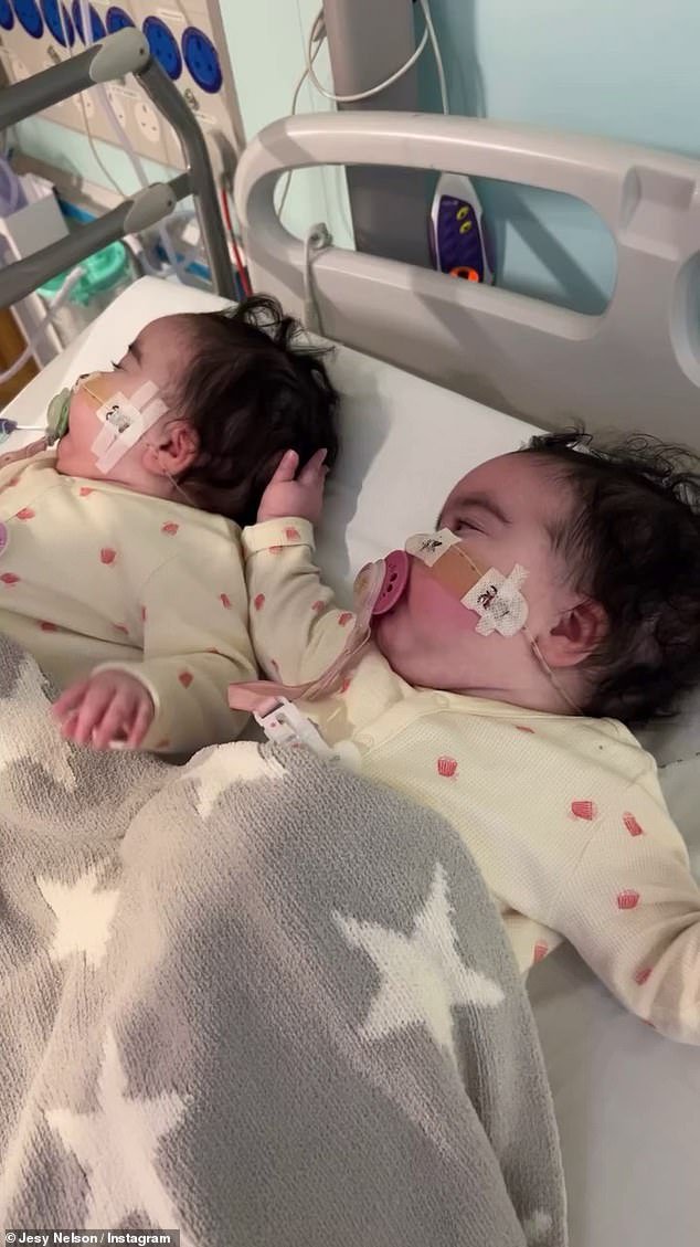 Jesy Nelson revela que sus hijas gemelas de 9 meses están siendo tratadas en el Great Ormond Street Hospital mientras comparte una imagen desgarradora de sus aparatos ortopédicos a juego en las piernas durante su tratamiento actual de AME