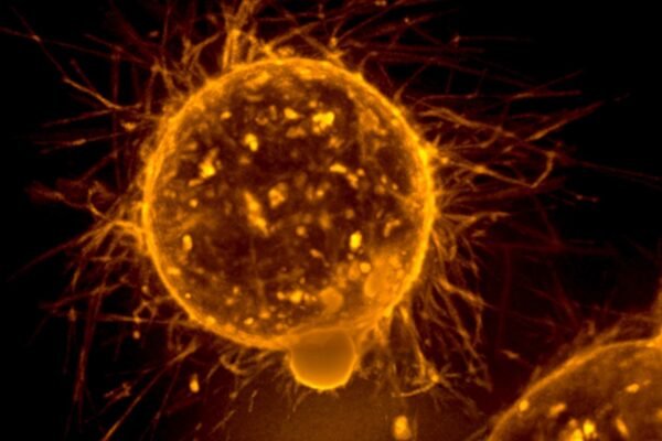 Por qué Novartis está pagando 2 mil millones de dólares por un medicamento contra el cáncer que logra el mismo objetivo que uno de sus propios productos