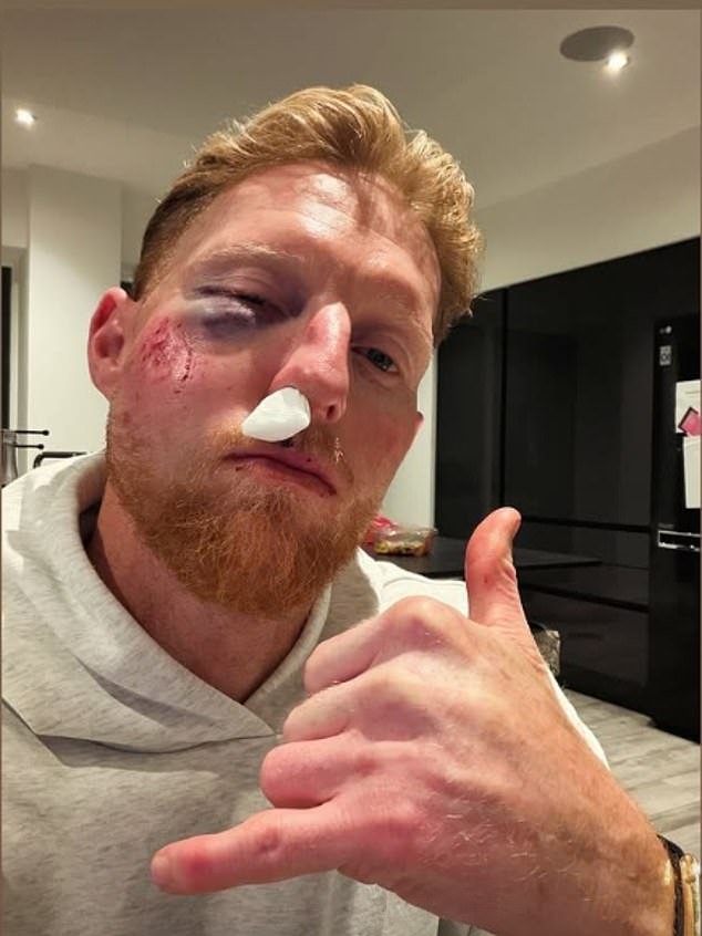 Ben Stokes revela que tiene “suerte” de estar vivo después de que una terrible lesión en el cricket dejara la cara del capitán de Inglaterra “destrozada” y requiriera una cirugía mayor: “Afortunadamente, todavía estoy aquí”