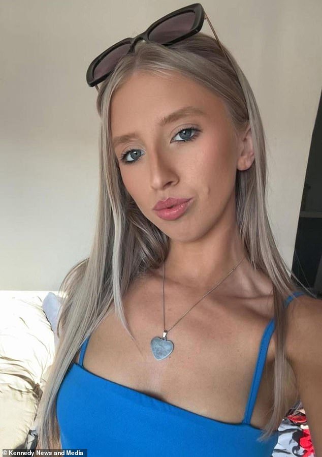 Un técnico de uñas casi muere a golpes en un ataque de perro no provocado y escapó con heridas horribles.