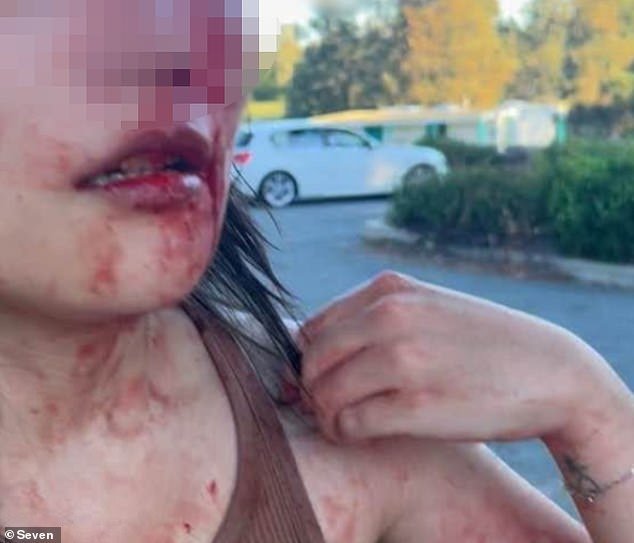 Canberra está al límite después de que otra mujer golpeara al azar y amenazara con un cuchillo a otra mujer en un vil ataque racista.