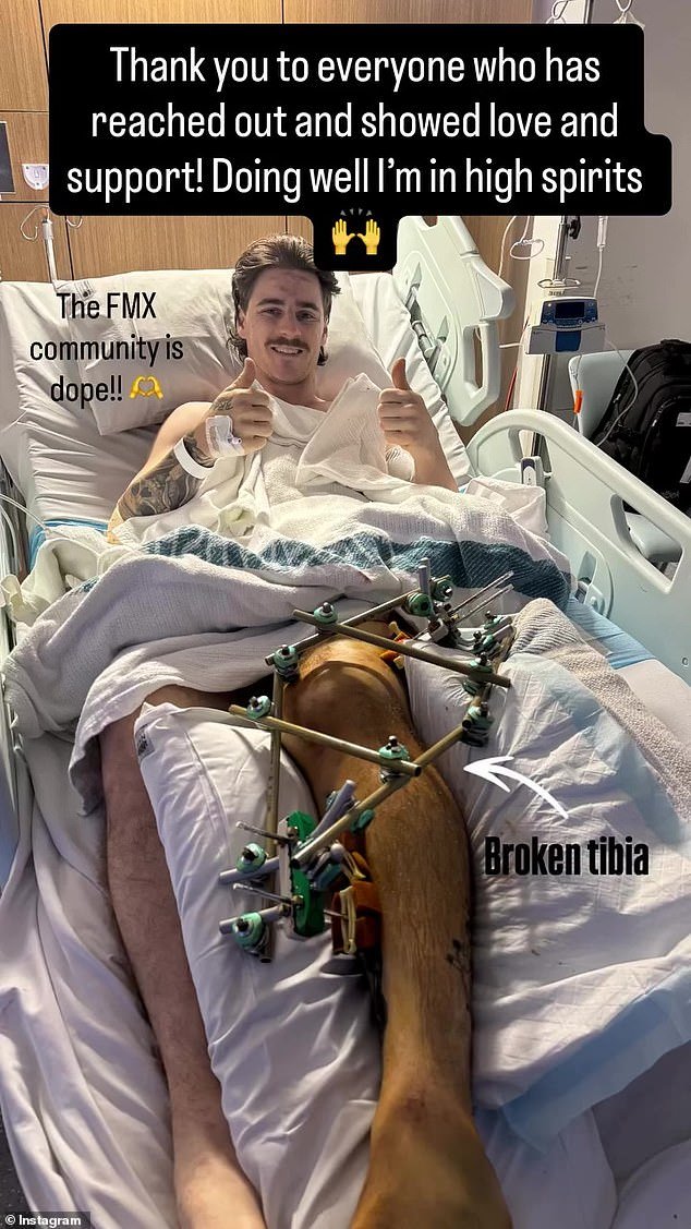 Mensaje de un piloto de motocross herido desde el hospital después de un accidente catastrófico en el Sydney Royal Easter Show: su esposa embarazada revela “un largo camino por delante”