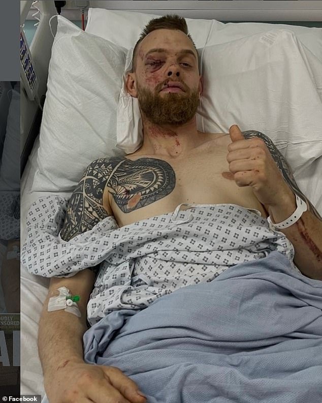 La estrella del speedway salió del hospital con una pierna rota, costillas, un PULMÓN perforado y una hemorragia cerebral menor después de un desagradable accidente mientras daba una actualización desde el hospital.