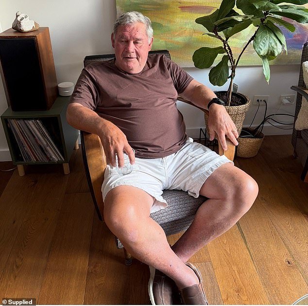 La leyenda del fútbol Graham Eadie está hospitalizada después de un terrible revés en su imposible batalla por la salud.