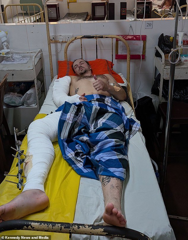 Un turista británico queda varado en el hospital con una factura de 40.000 libras esterlinas por motivos de seguro tras ser derribado de su motocicleta tres horas después de llegar a Sri Lanka