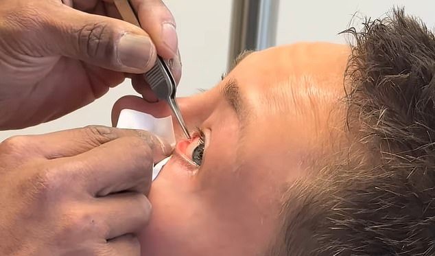 La estrella de UFC Rose Namajunas comparte un inquietante clip quirúrgico después de que fue brutalmente apuñalada en el ojo durante una pelea.