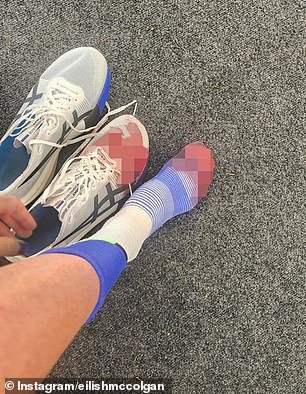 El ‘pie’ de una importante corredora británica explota durante el maratón de Londres mientras revela fotos espantosas, después de continuar luchando para terminar con un tiempo increíble.