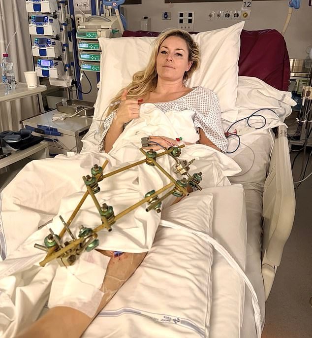 Lindsey Vonn se acerca al retiro mientras amenaza con desafiar las desesperadas súplicas de su padre después de casi perder su pierna en un horrible accidente olímpico.