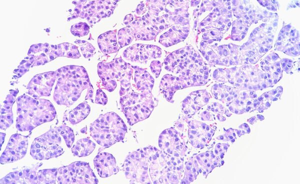 Oricell recauda 110 millones de dólares para impulsar la terapia con células cancerosas a un nuevo territorio