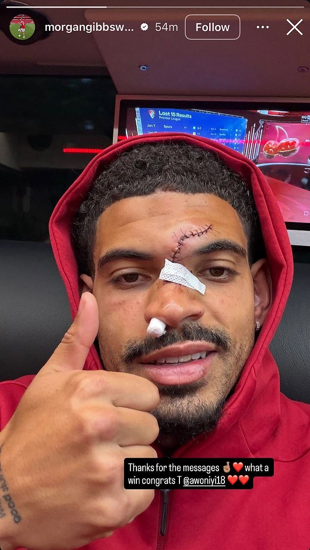 Nottingham Forest está considerando equipar a Morgan Gibbs-White con una MÁSCARA después de la horrible colisión de la estrella con la estrella del Chelsea, Robert Sánchez, en la victoria por 3-1.