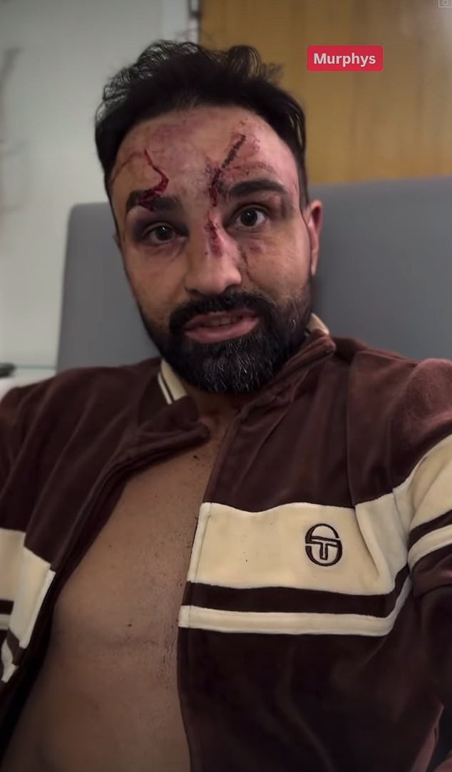 Boxeador estadounidense ataca a puño limpio al personal del NHS al que “no se le permite trabajar con animales de granja” en EE. UU. porque sufre infecciones después de su pelea
